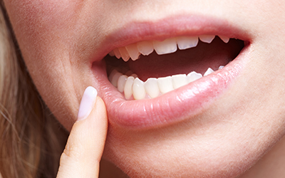 Woman's mouth slightly open