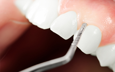 Gums examination
