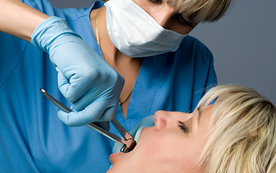 Tooth extraction