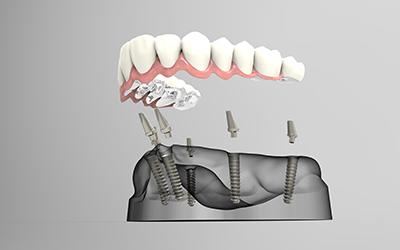 3D rendering teeth