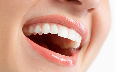 Close-up of a smile with teeth