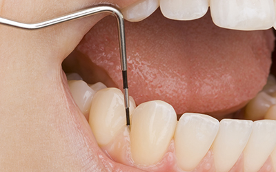 close-up a persons gums