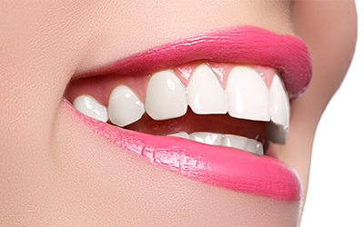 An up-close of a woman smiling